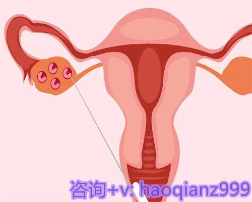 北京正规公司供卵女孩，北京家圆医院供卵流程