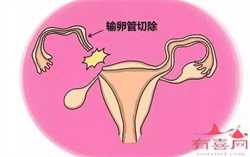 患有多囊卵巢可以怀孕吗